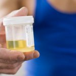 Анализ мочи у собак