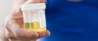 Анализ мочи у собак