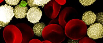 What is sepsis in dogs