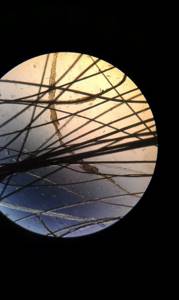 Фото 2 – Пораженный грибком волос при микроскопическом исследовании