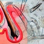 Где обитает клещ