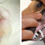 Как обнаружить бородавки