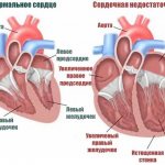 Сердечная недостаточность у собак