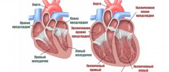 Сердечная недостаточность у собак