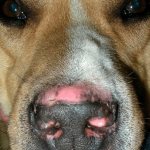 Симптомом аспергеллеза является депигментация носа