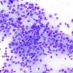 венерическая саркома у собак