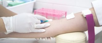 Внутривенные инъекции, техника, алгоритмы выполнения