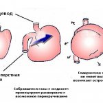 Вздутие живота у собаки